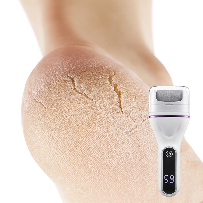 🔥Hot Sale For 50% 0FF🔥✨Portable Electric Foot Callus Remover - Quick & Efficient Dead Skin Removal🦶